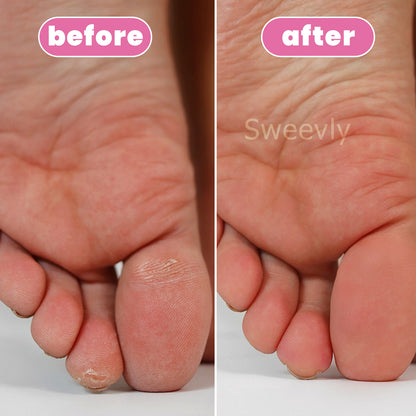 Sweevly - Smooth Pedicure Wand